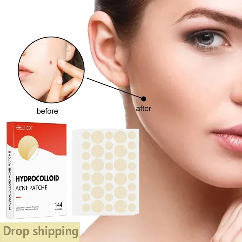 Invisible Acne Patches 144 Count