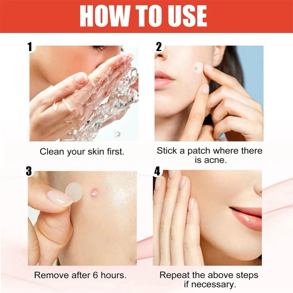 Invisible Acne Patches 144 Count