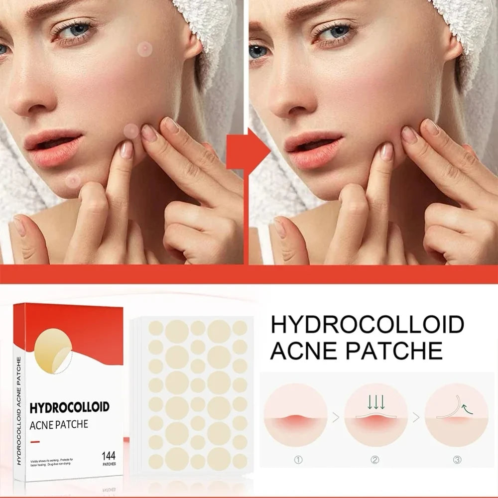 Invisible Acne Patches 144 Count