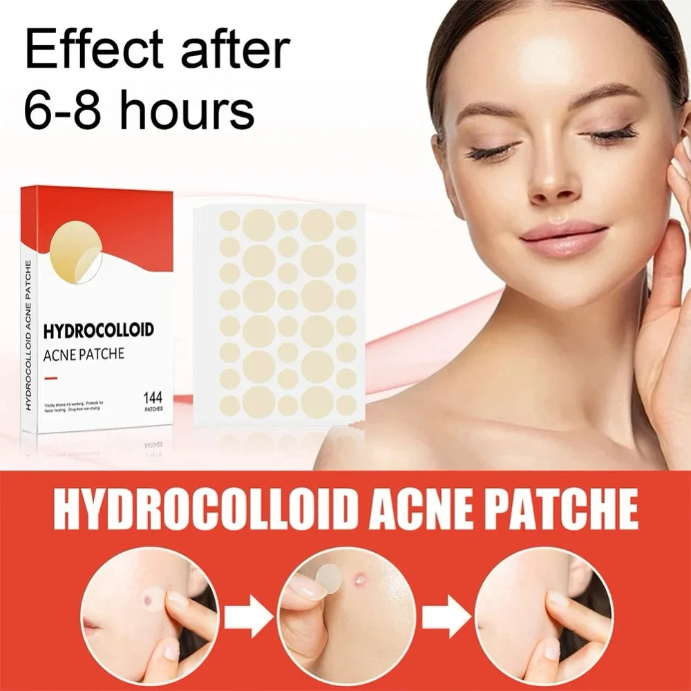 Invisible Acne Patches 144 Count